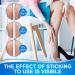 Varicose Veins Treatment Patch - 16 Count Pack for Leg Pain Relief and Improved Blood Circulation - Buy Online on GoSupps.com