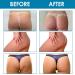 Buy Buttock-Lifting & PO Enlargement Patches | Hip Firm Lift & Body Tightening Stickers - International Shipping Available - Buy Online on GoSupps.com