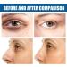 Eye Gels with Natural Marine Collagen & Hyaluronic Pearl Eye Masks for Puffy Eyes Eye Gel Pads for Puffy Eyes Anti Aging Eye Bags for Women Under Eye Patches Fine Lines Eye Bags Puffiness - Buy Online on GoSupps.com