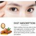 Retinol Eye Cream for Dark Circles and Puffiness Anti Aging Under Eye Cream Retinol Serum for Face Eye Stick - Buy Online on GoSupps.com