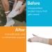 Houseables 6 Elastic Bandage Wrap 2 Pack - Cotton Compression Wraps with Hook & Loop - Wide Surgical Bandages for Leg, Knee, Sprain - 13-15 Stretched - Beige - Buy Online on GoSupps.com