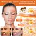 LOVILDS Bee Venom Skin Restoration Cream Professional Bee Venom Skin Treatment Cream Bee Venom Comprehensive Cream-50g Moisturizing & Repair Reduces Blemishes for All Skin Type (1 Bottle) - Buy Online on GoSupps.com