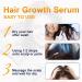 Minoxidil Hair Growth Serum - Biotin Treatment for Stronger, Thicker Hair - Prevent Hair Loss & Regrow Naturally - 1Fl Oz - Buy Online on GoSupps.com
