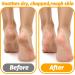 COMNICO 3 Pairs Moisturizing Socks Overnight Cotton Lotion Socks Soft Feet Moisturizer Spa & Pedicure Socks for Dry Feet Cracked Heels Men Women Foot Care Moisture Enhancing Socks One Size Fits Most - Buy Online on GoSupps.com
