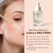 PDRN Salmon DNA Serum Anti-Aging Face Serum with Hyaluronic Acid Tripeptide & Vitamins (10 000ppm) Hydrating Facial Serum for Blemishes Collagen Boost & Fine Lines Korean Skincare 1 Fl Oz - Buy Online on GoSupps.com