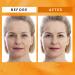 Super Vitamin C Serum for Women 60+: Hyaluronic Acid Anti-Aging Face Serum for Dark Spots & Wrinkles - Perfect for Mature Skin - Buy Online on GoSupps.com
