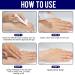 Surgical Scar Remover Gel with Retinol, Allantoin, Vitamin E - For Old & New Scars, C-Section, Keloid, Burn, Acne - Buy Online on GoSupps.com