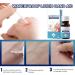 DingM 10ml Liquid Bandage - Waterproof & Breathable Wound Care Gel for Minor Cuts, Scrapes, and Cracked Skin - Transparent Formula, Quick-Dry Solution - Buy Online on GoSupps.com