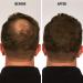 Infinity Hair Fiber - Hair Loss Concealer for Men & Women - Dark Brown 30g - Buy Online on GoSupps.com