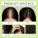 Hair Regrowth S rum de croissance des cheveux syst me de repousse des cheveux s rum de croissance des cheveux traitement avanc traitement pour plus pais renforce les racines (1 bo te) - Buy Online on GoSupps.com