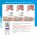 Upgrade Skin Tag Remover Kit for Men & Women - 36 Skin Shields & Repair Lotion - Safe and Effective Skin Tag and Mole Corrector Set - Buy Online on GoSupps.com