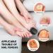 Buy Nail Fungus Light Device for Home Use - Treat Onychomycosis on Fingernails & Toenails | Effective for Damaged Discolored & Thickened Nails - Buy Online on GoSupps.com