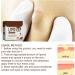 LumpFree Lipoma Cr me d maquillante instantan e au lipome cr me d maquillante aux lipomes aux herbes cr me v g tale naturelle pour liminer les grumeaux de lipome 20 g - Buy Online on GoSupps.com