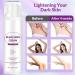 Skin Bleaching Cream For Dark Skin Lightening Underarm Whitening Cream Contain Vitamin C For Armpit Knees Elbows Inner Thighs And Bikini Area - Buy Online on GoSupps.com