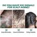 Allayu Adults Dense Hair Growth Essential Oil Natural Ingredient Regrowth Follicle Repair Essence Serum Beauty Supplies - Buy Online on GoSupps.com