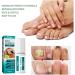 2 IN 1 Nail Fungus Treatment Oil - Fast Relief for Toenail Paronychia & Fungal Infections - Buy Online on GoSupps.com