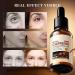 Caffeine Dark Circles Eye Serum Caffeine Serum For Anti Aging Caffeine Face Serum For Reduce Wrinkles Eye Bag Removal Serum Anti Wrinkle Serum Targets Eye Lines & Face Wrinkle 30 ml - Buy Online on GoSupps.com