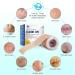 Silicone Scar Sheets 1.6x60 - Reusable & Effective Treatment for C-Section, Burn, Surgery, Acne Scars - Buy Online on GoSupps.com