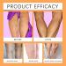 DAPANGGE Turmeric Varicose Vein Patch Turmeric Varicose Vein Patches Varicose Veins Patch Relief Varicose Veins Treatment Patch Naturally Relieves Varicose Veins in Legs and Spiders One Box - Buy Online on GoSupps.com