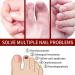 Fungal Nail Treatment - Nail Fungus Treatment For Toenail - Extra Strong Toe Nail Fungal Treatment - Anti fungus Nail Repair and Strengthen Fix & Renew Damaged Broken Nails - Buy Online on GoSupps.com