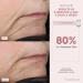 NuFACE Mini & FIX Starter Kits - FDA Cleared Microcurrent Device for Face Sculpting & Line Smoothing - Aqua Gel & FIX Serum Included - Buy Online on GoSupps.com