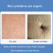 VolksRose Abdomen Lift Tapes - Anti-Wrinkle Silicone Patches for Sagging Skin Reusable Tummy Sculpting Pads Smooths Belly Wrinkles | International Shipping Available - Buy Online on GoSupps.com
