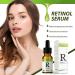 Trendyfave Retinol Serum for Face 2.5% Retinol Intense Serum Reduce Wrinkle Fine Line & Dark Circle Face Serum with Retionl Hyaluronic Acid Vitamin C & E Anti-aging Moisturiser - Buy Online on GoSupps.com