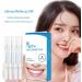 4 Pack Teeth Whitening Pens - Professional Abbey Whitening Essence for Painless Tooth Bleaching & Bright White Smile - Buy Online on GoSupps.com