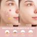 VEGCOO 272 Pi ces Patch Bouton Pimple Patches Patch Anti Bouton d'Acn Pansement Hydrocollo de Imperm able et Hydratant pour Favoriser la Gu rison de l'Acn  - Buy Online on GoSupps.com