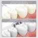 Sonic Electric Toothbrush for Adults - 8 Brush Heads 4 Modes Smart Timer IPX8 Fast Charge - Perfect Christmas Gift (White - Buy Online on GoSupps.com