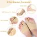 MxTimwan Hallux Valgus Socks - 2 Pairs for Toe Pain Relief | Beige Correction & Foot Comfort | Unisex Size L - Buy Online on GoSupps.com