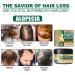 Buy RVTKAK 30g Ginger Hair Care Cream | Deep-Cleansing Scalp Conditioner & Moisturizing Hair Follicle Essence - International Shipping Available - Buy Online on GoSupps.com