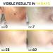 Dark Spot Remover Set - 2 PCS Advanced Formula with Niacinamide & Vitamin C | Fast Results in 14 Days | DOUBLE YELLOW - Buy Online on GoSupps.com