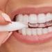 Orthodontic Chewies for Aligners - Fast Seating Aid Reusable & Durable Flavorless - Shop Now - Buy Online on GoSupps.com