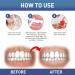 Attdx Rubber Immediate Treatment Gel - Instant Relief for Gums | Gum Sooting & Periodontal Care (5 Sticks) - International Shipping Available - Buy Online on GoSupps.com