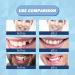 Suphyee Provisional Denture Kit | Temporary Repair Set for Broken Teeth - Restore Missing Teeth Easily - Buy Online on GoSupps.com