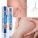 Veinhealth Blue Light Therapy Set for Varicose Veins - Effective Treatment Cream for Legs - Buy Online on GoSupps.com