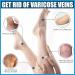 Natural Varicose Veins Relief Cream for Legs - Spider Vein & Varicose Vein Treatment - Buy Online on GoSupps.com