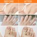 Hair Removal Cream Upper Lip Hair Cream Legs & Body Sensitive Skin 20g Painless And Effective Facial Hair Removal Cream  - Buy Online on GoSupps.com