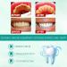 Teethaid Mouthwash 60ml - Effective Tooth Whitening & Dental Aid | International Shipping - Buy Online on GoSupps.com
