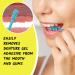 Denture Dart V4 Hard Plastic Denture Brush - Gel Adhesive Remover for Mouth & Gums - Oral Hygiene Scraper with Textured Grip - Blue - Buy Online on GoSupps.com