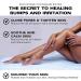 Bump Patrol For Her - Soothing Aftershave for Women | Razor Bumps & Ingrown Hair Relief for Bikini Underarms & Legs - Buy Online on GoSupps.com
