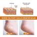 Horse Oil Foot Repair Cream 3Pcs 30g Foot Care Cream Easily Absorbed Moisturizing Horse Oil Foot Care Cream for Extremely Dry Cracked Feet - Buy Online on GoSupps.com