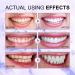 Lila Toothpaste for White Teeth - Purple Tooth Whitening Paste 60g (2-Pack) | Fresh Breath & Stain Removal - Buy Online on GoSupps.com