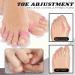 Hammer Toe Corrector 1 Pack - Soft Gel Crests Splints for Foot Pain Relief - Flexible Overlap Toe Straightener & Pumice Stone Included (Pink) - Buy Online on GoSupps.com