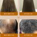 Natural Hair Regrowth - Hair Loss Treatment Volume & Root Booster 30ml Moisturizing Hair Treatment for Stronger Hair Plus Anloximt - Buy Online on GoSupps.com