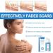 Silicone Scar Remover Gel - Effective for Old & New Scars - 1.06 oz - 3PCS Set - Buy Online on GoSupps.com