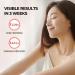 IOPE Super Vital Cream Rich 50ml - Anti-Aging Moisturizer for Brightening, Wrinkle Reduction, and Deep Hydration - Buy Online on GoSupps.com