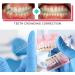 Buy 300PCs Dental Orthodontic Latex Elastics | Elastic Braces Gum & Toothed Gum Pull Tapes | High-Quality Rubber Bands for Orthodontics - Buy Online on GoSupps.com
