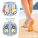 Bunion Support Sleeve with Silicone Gel Pads - 2 Pack Toe Protectors for Big Toe Pain Relief (S-M US 6-10) - All Things Accessory - Buy Online on GoSupps.com